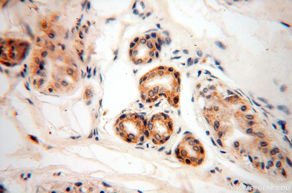 Immunohistochemistry (IHC) staining of human skin tissue using UBE2DNL Polyclonal antibody (17287-1-AP)