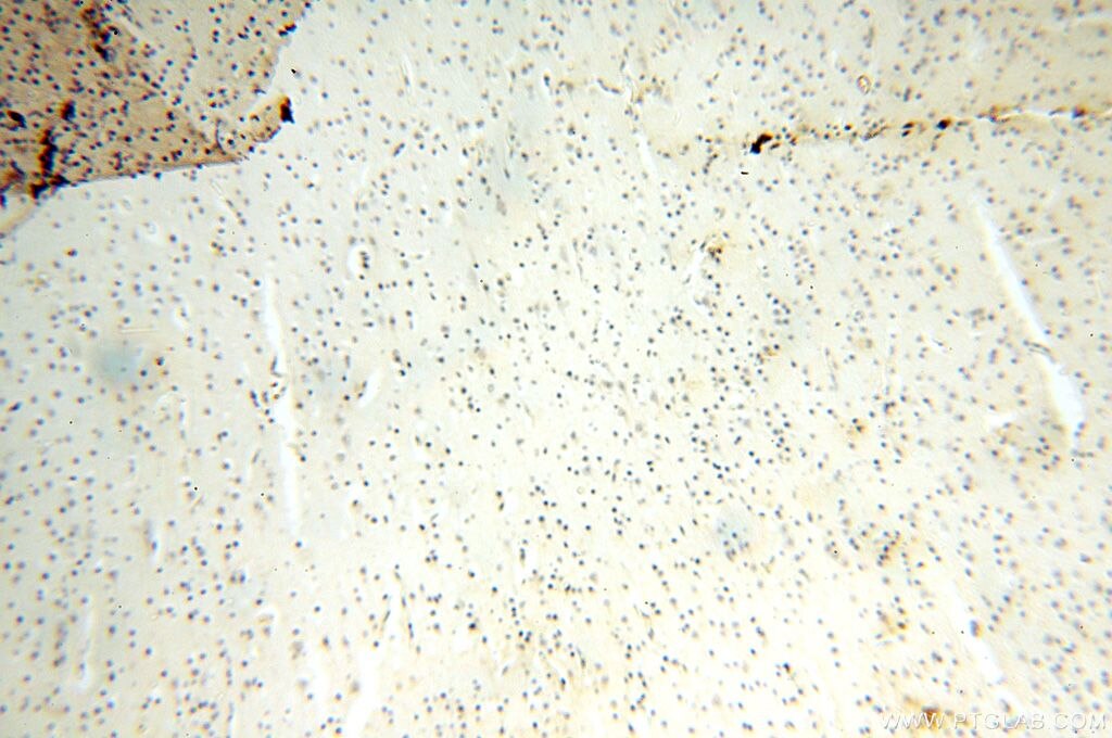 Immunohistochemistry (IHC) staining of human brain tissue using UBE2DNL Polyclonal antibody (17287-1-AP)