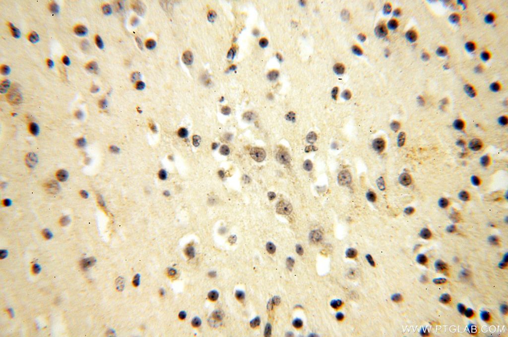 Immunohistochemistry (IHC) staining of human brain tissue using UBE2DNL Polyclonal antibody (17287-1-AP)