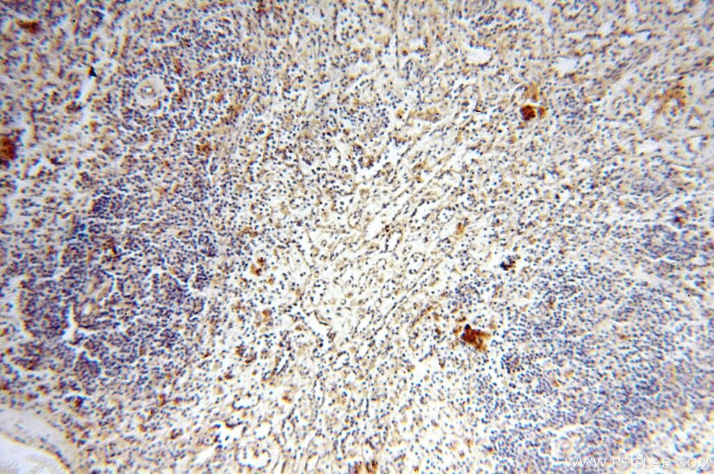 IHC staining of human spleen using 17287-1-AP