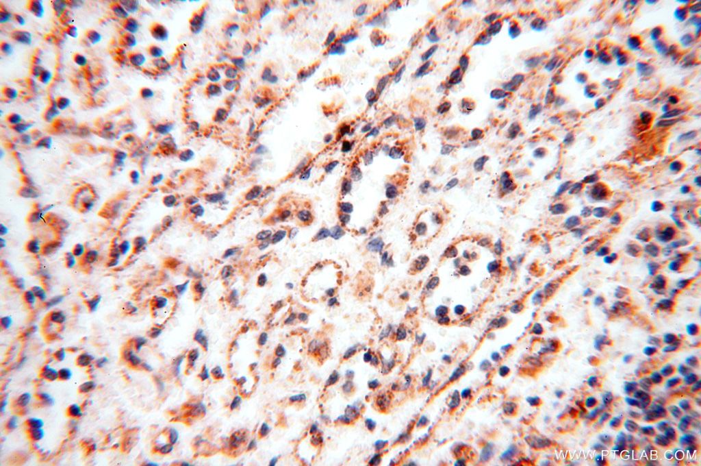 Immunohistochemistry (IHC) staining of human spleen tissue using UBE2DNL Polyclonal antibody (17287-1-AP)