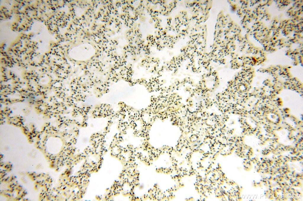 Immunohistochemistry (IHC) staining of human lung tissue using UBE2DNL Polyclonal antibody (17287-1-AP)