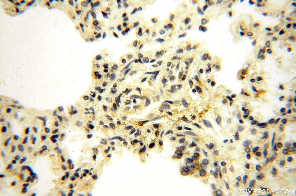 Immunohistochemistry (IHC) staining of human lung tissue using UBE2DNL Polyclonal antibody (17287-1-AP)