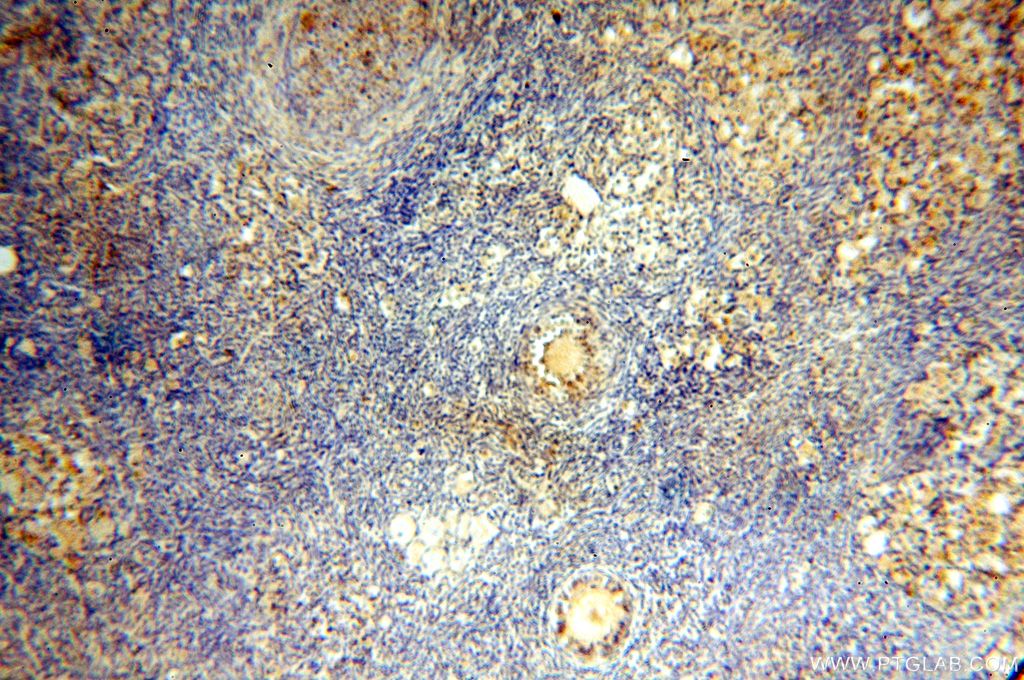 Immunohistochemistry (IHC) staining of human ovary tissue using UBE2DNL Polyclonal antibody (17287-1-AP)