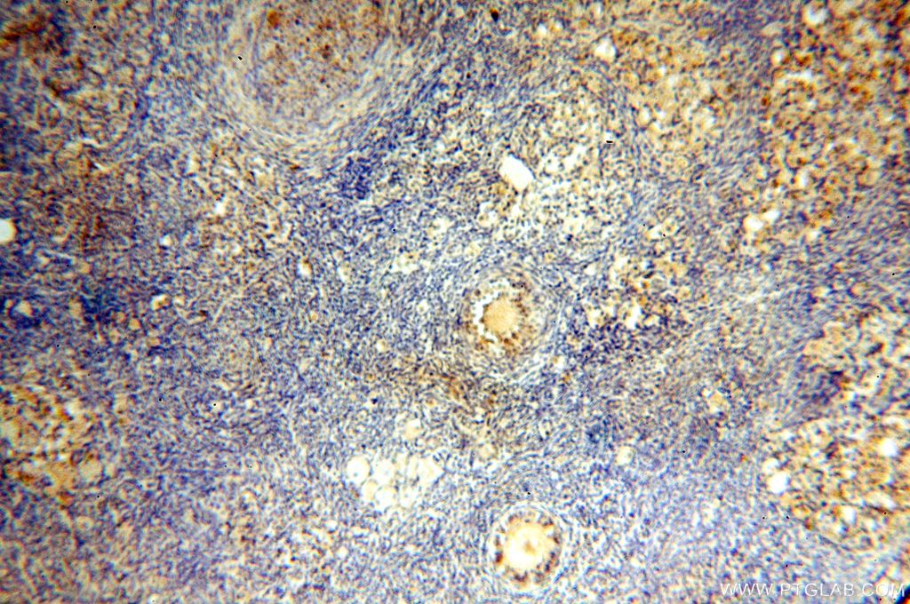 IHC staining of human ovary using 17287-1-AP