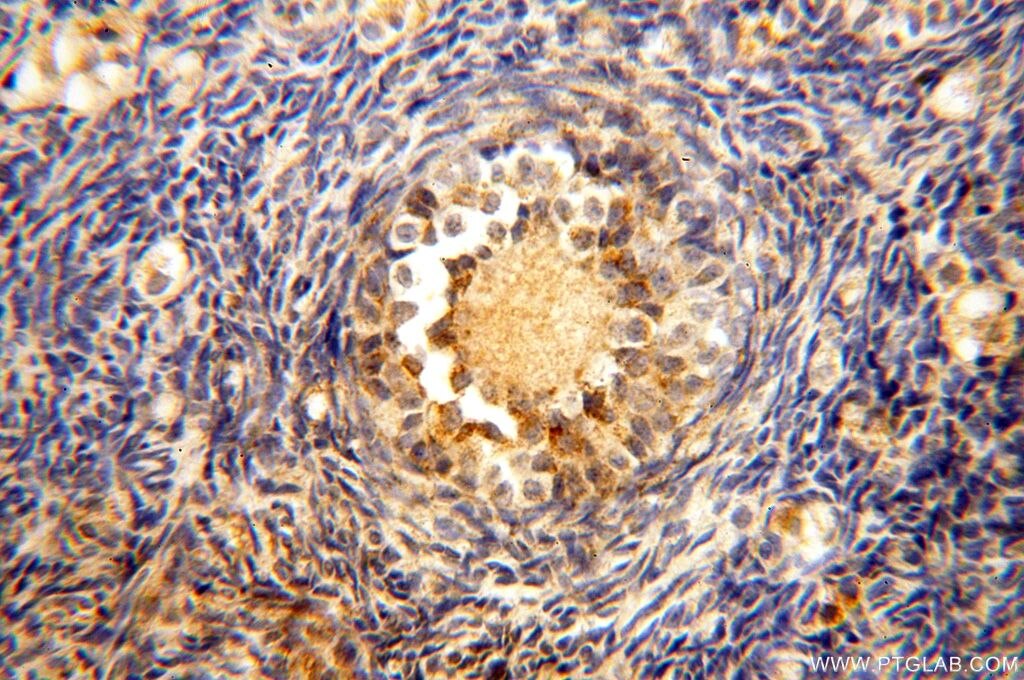 Immunohistochemistry (IHC) staining of human ovary tissue using UBE2DNL Polyclonal antibody (17287-1-AP)