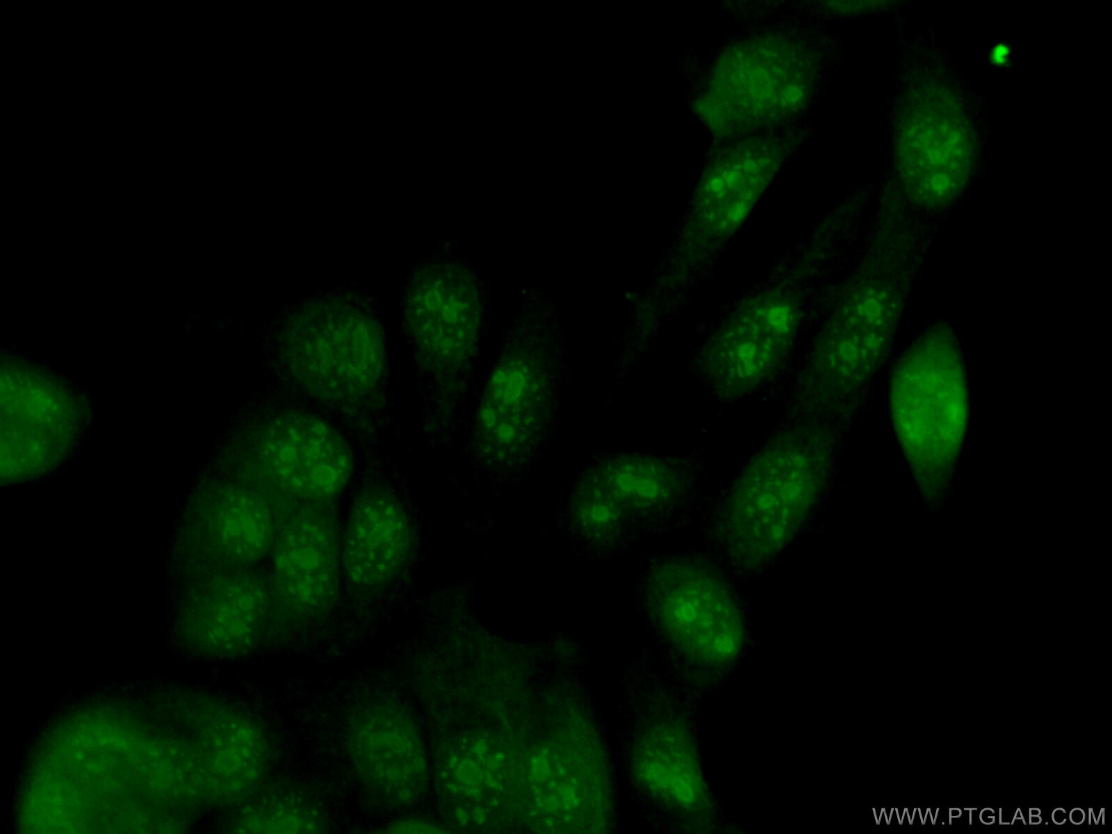 Immunofluorescence (IF) / fluorescent staining of MCF-7 cells using UBE2E1 Polyclonal antibody (55457-1-AP)