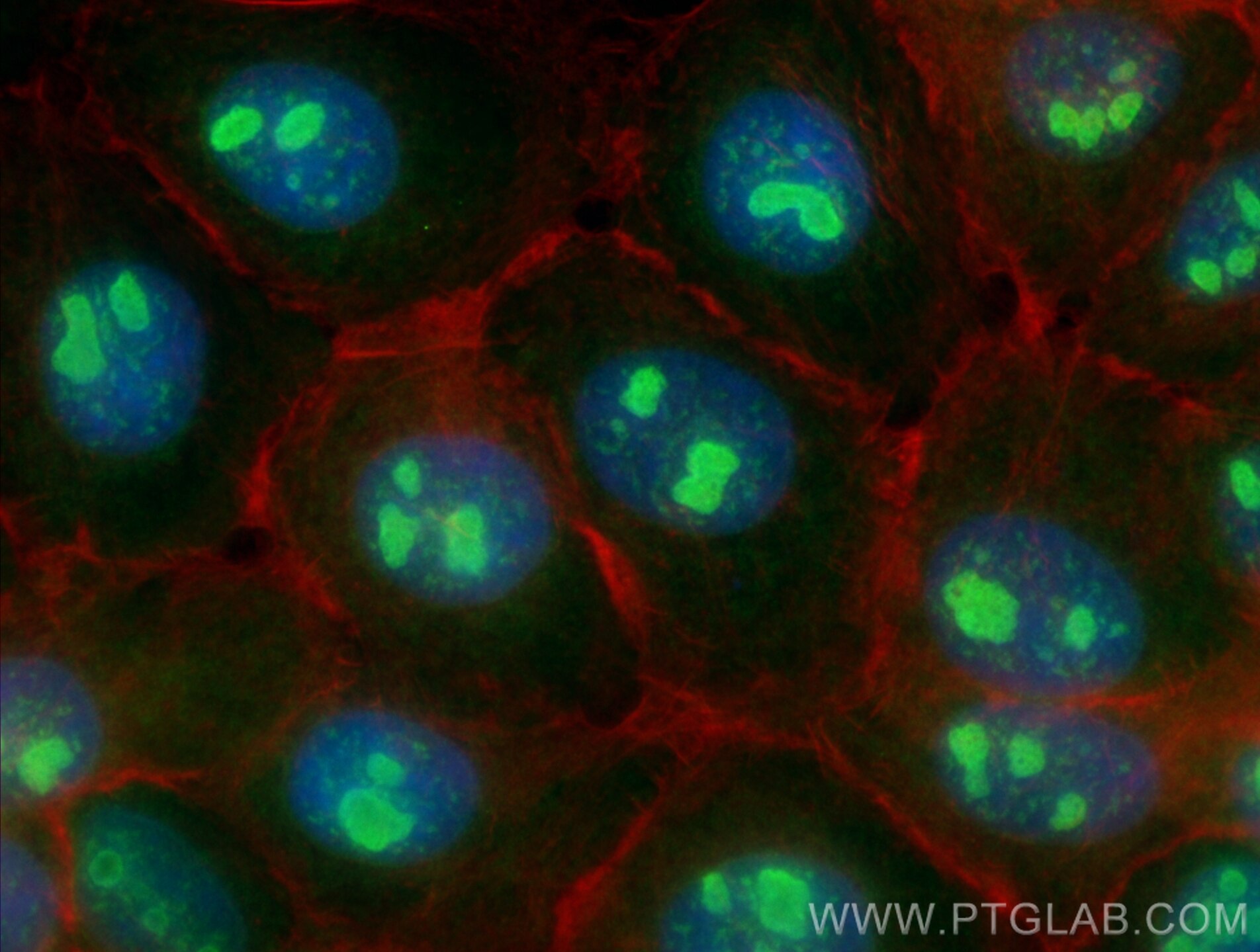 Immunofluorescence (IF) / fluorescent staining of A431 cells using UBE2E1 Polyclonal antibody (55457-1-AP)