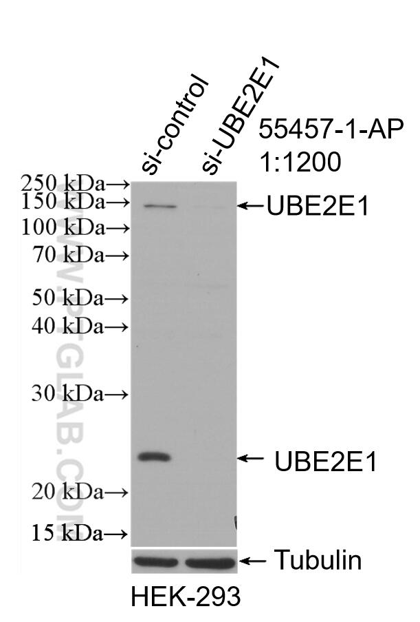 Western Blot (WB) analysis of HEK-293 cells using UBE2E1 Polyclonal antibody (55457-1-AP)