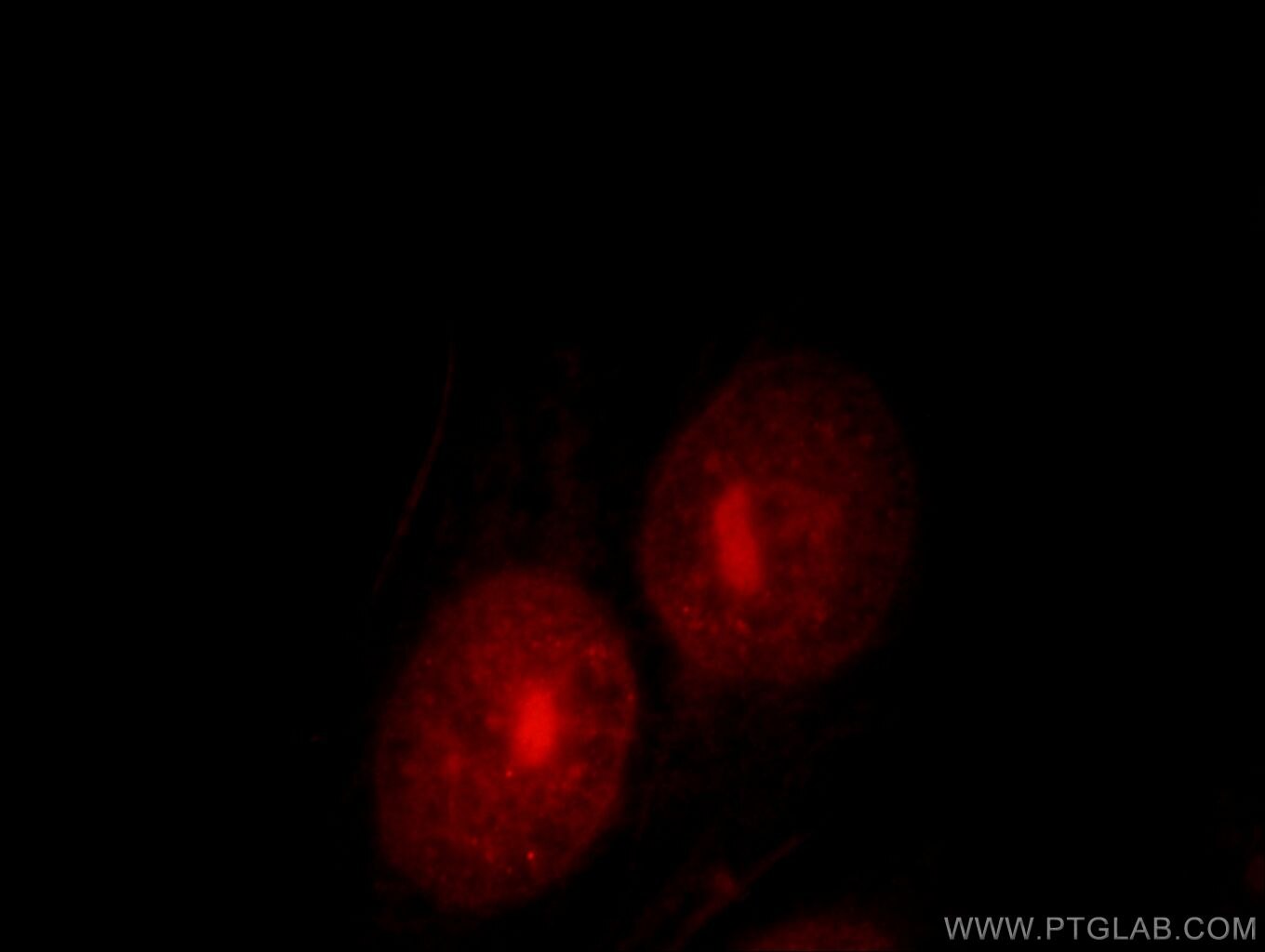 Immunofluorescence (IF) / fluorescent staining of HepG2 cells using UBE2E2 Polyclonal antibody (11844-1-AP)