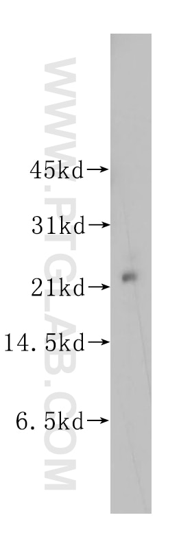 Western Blot (WB) analysis of human brain tissue using UBE2E2 Polyclonal antibody (11844-1-AP)