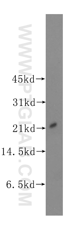 Western Blot (WB) analysis of mouse embryo tissue using UBE2E2 Polyclonal antibody (11844-1-AP)