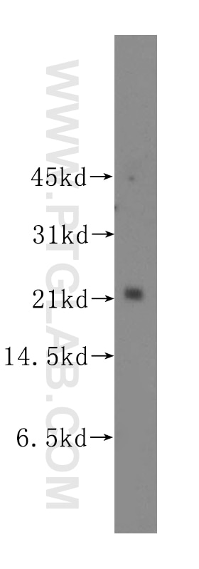 Western Blot (WB) analysis of human thyroid gland tissue using UBE2E2 Polyclonal antibody (11844-1-AP)