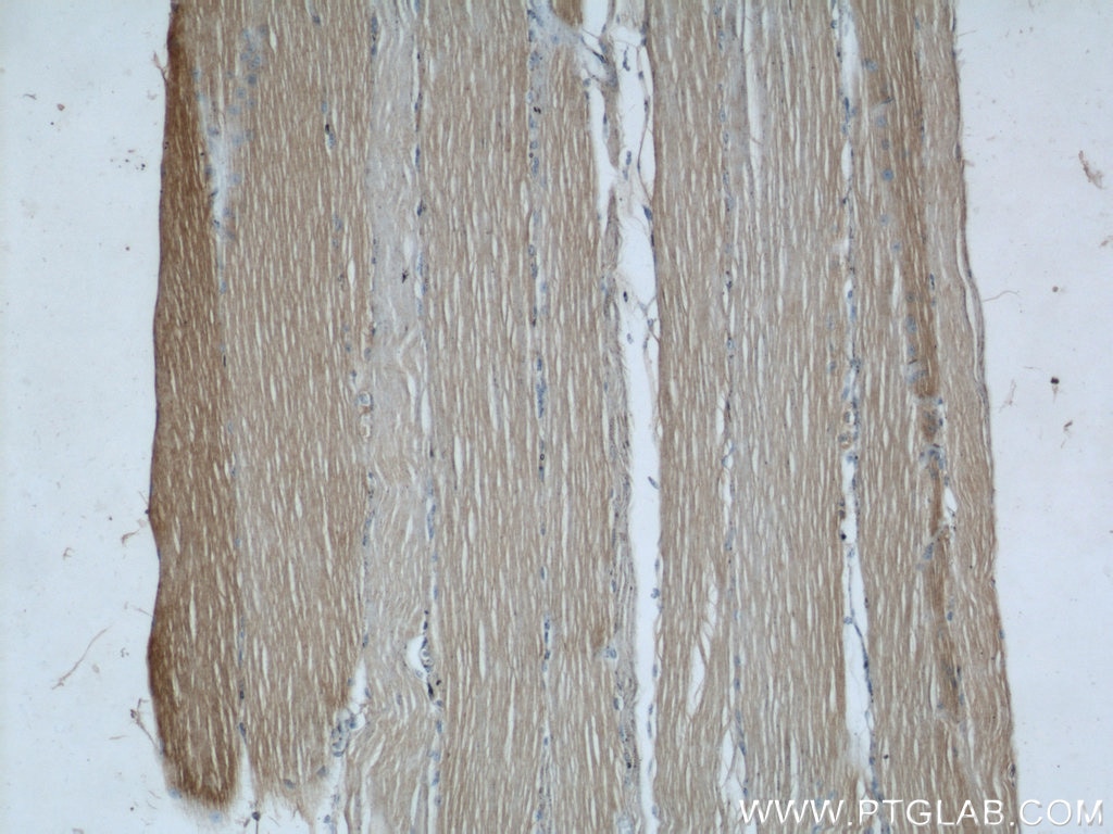 Immunohistochemistry (IHC) staining of human skeletal muscle tissue using UBE2E3 Polyclonal antibody (15488-1-AP)