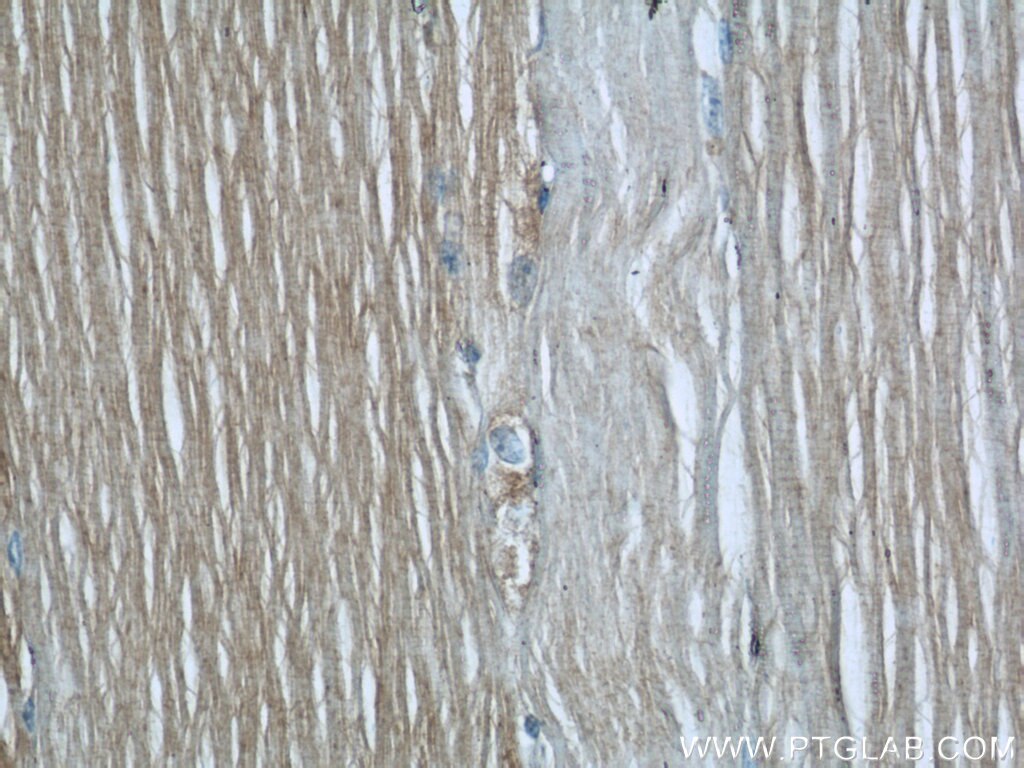 Immunohistochemistry (IHC) staining of human skeletal muscle tissue using UBE2E3 Polyclonal antibody (15488-1-AP)