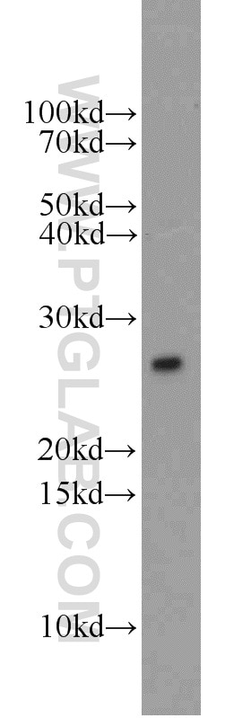 Western Blot (WB) analysis of mouse liver tissue using UBE2E3 Polyclonal antibody (15488-1-AP)