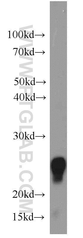 WB analysis of mouse kidney using 15488-1-AP