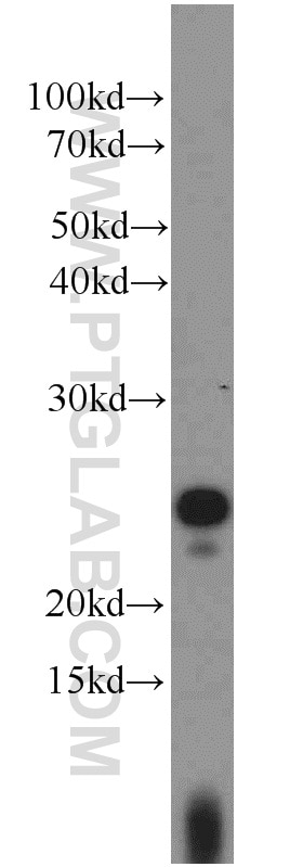 Western Blot (WB) analysis of Jurkat cells using UBE2E3 Polyclonal antibody (15488-1-AP)