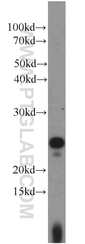 WB analysis of Jurkat using 15488-1-AP
