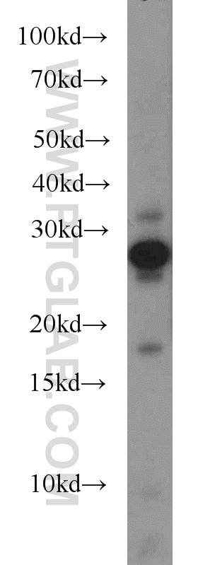 Western Blot (WB) analysis of Y79 cells using UBE2E3 Polyclonal antibody (15488-1-AP)