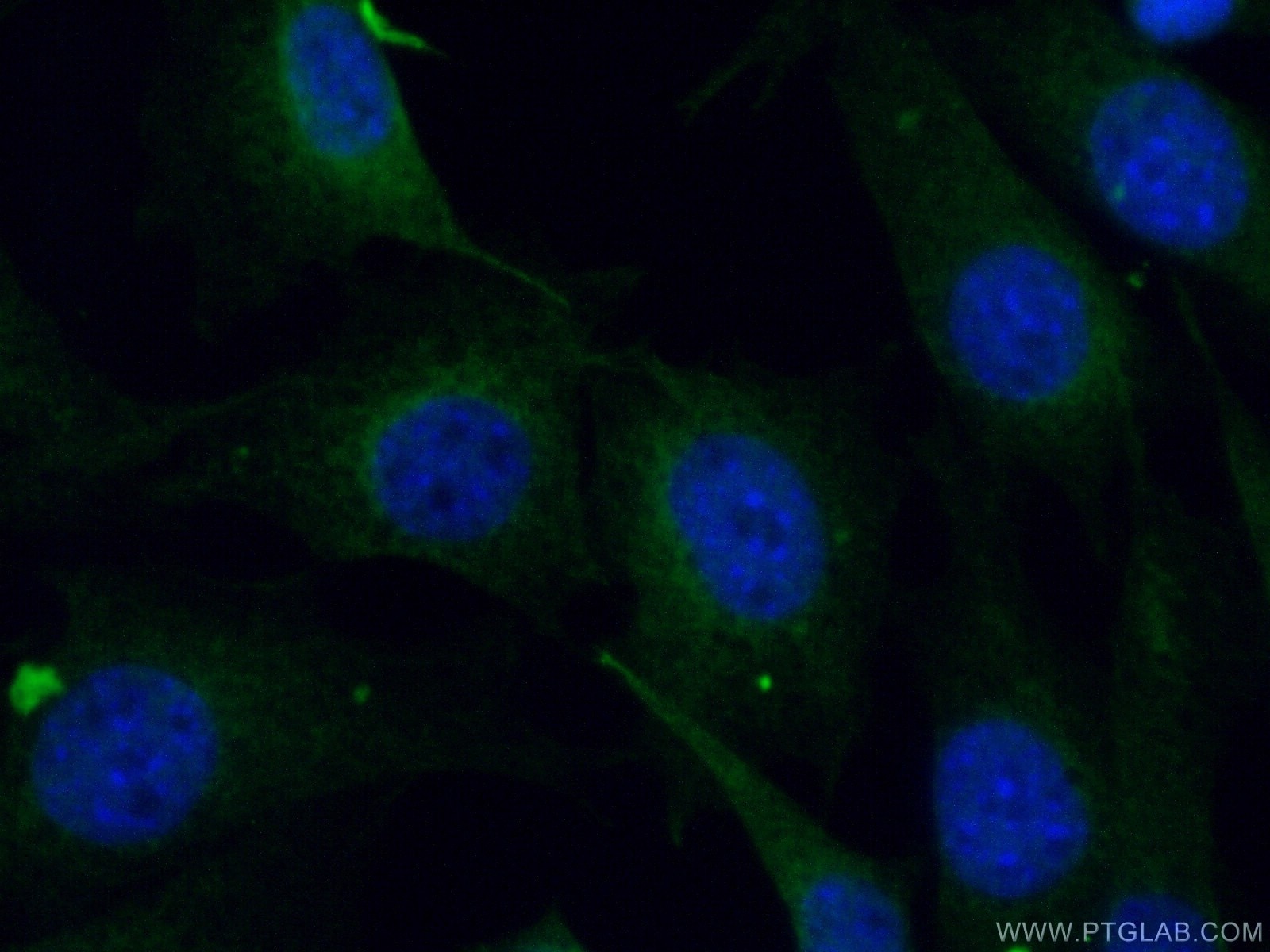 Immunofluorescence (IF) / fluorescent staining of NIH/3T3 cells using UBE2F Polyclonal antibody (17056-1-AP)