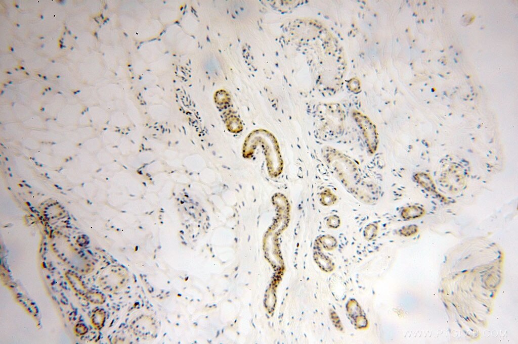 Immunohistochemistry (IHC) staining of human skin tissue using UBE2F Polyclonal antibody (17056-1-AP)