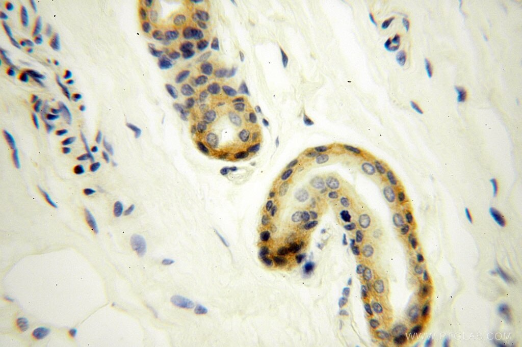 Immunohistochemistry (IHC) staining of human skin tissue using UBE2F Polyclonal antibody (17056-1-AP)