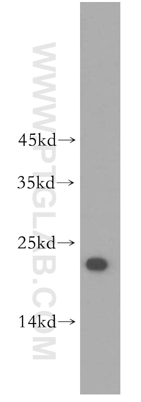 Western Blot (WB) analysis of Jurkat cells using UBE2F Polyclonal antibody (17056-1-AP)