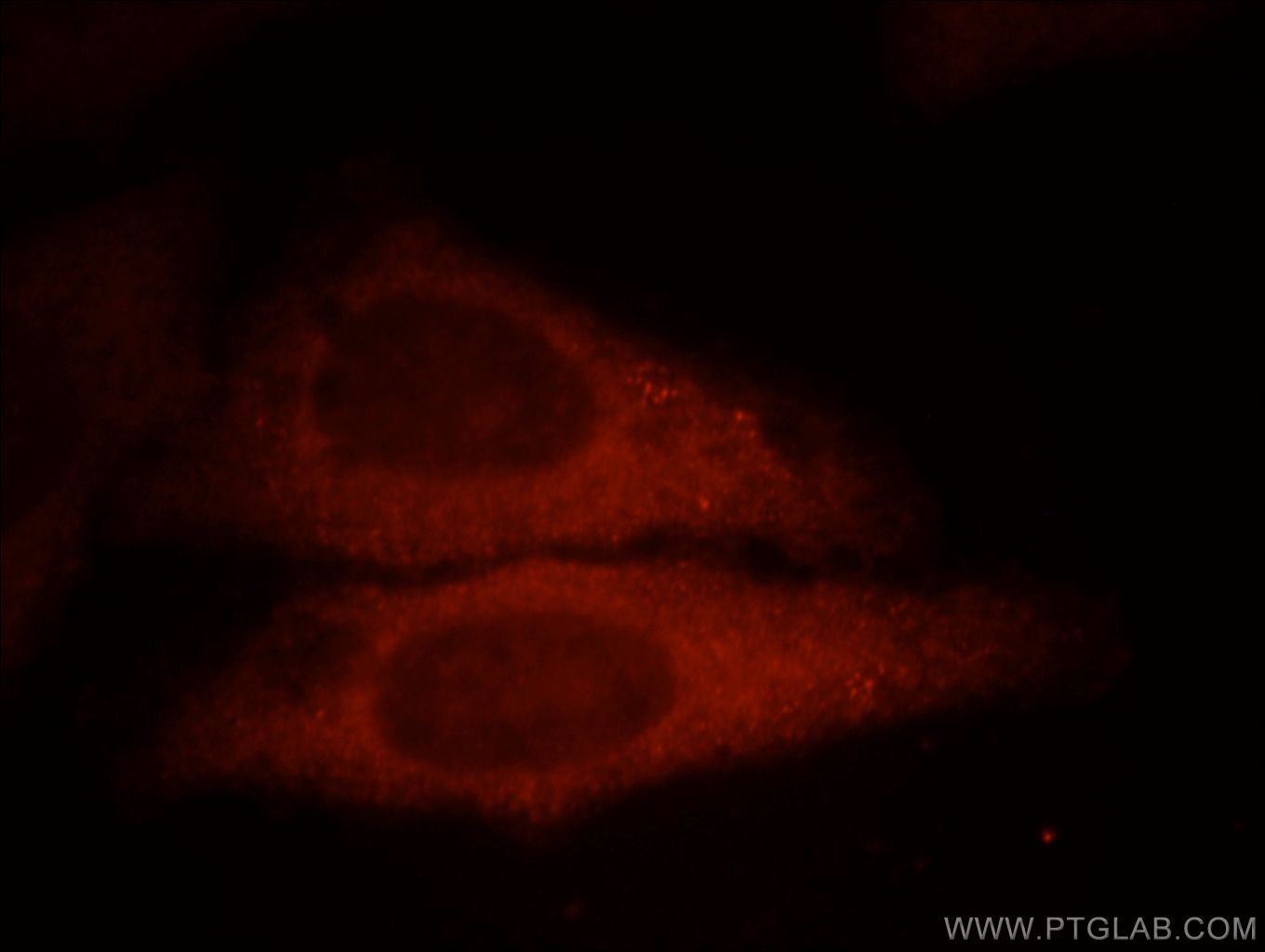Immunofluorescence (IF) / fluorescent staining of HepG2 cells using UBE2G1 Polyclonal antibody (12012-1-AP)