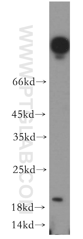 Western Blot (WB) analysis of HeLa cells using UBE2G1 Polyclonal antibody (12012-1-AP)