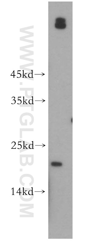 Western Blot (WB) analysis of HeLa cells using UBE2G1 Polyclonal antibody (12012-1-AP)