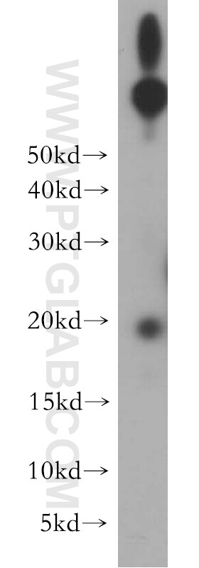 Western Blot (WB) analysis of HeLa cells using UBE2G1 Polyclonal antibody (12012-1-AP)