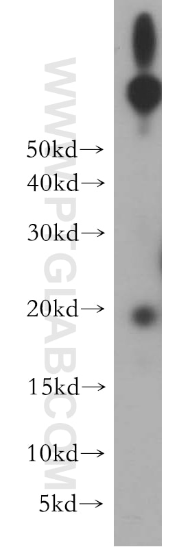 Western Blot (WB) analysis of HeLa cells using UBE2G1 Polyclonal antibody (12012-1-AP)