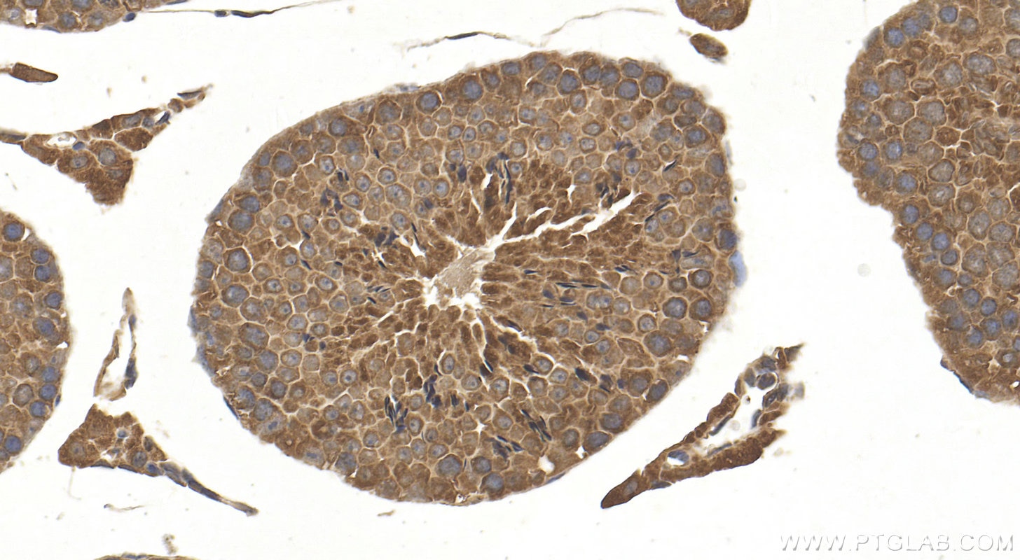 Immunohistochemistry (IHC) staining of mouse testis tissue using UBE2G2 Polyclonal antibody (10722-1-AP)