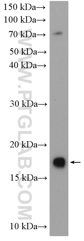 Western Blot (WB) analysis of Jurkat cells using UBE2G2 Polyclonal antibody (10722-1-AP)