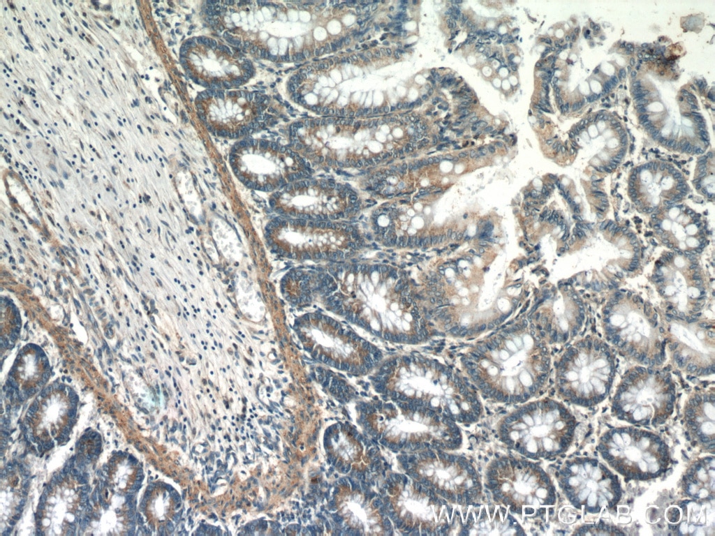 Immunohistochemistry (IHC) staining of human colon tissue using UBE2H Polyclonal antibody (15685-1-AP)