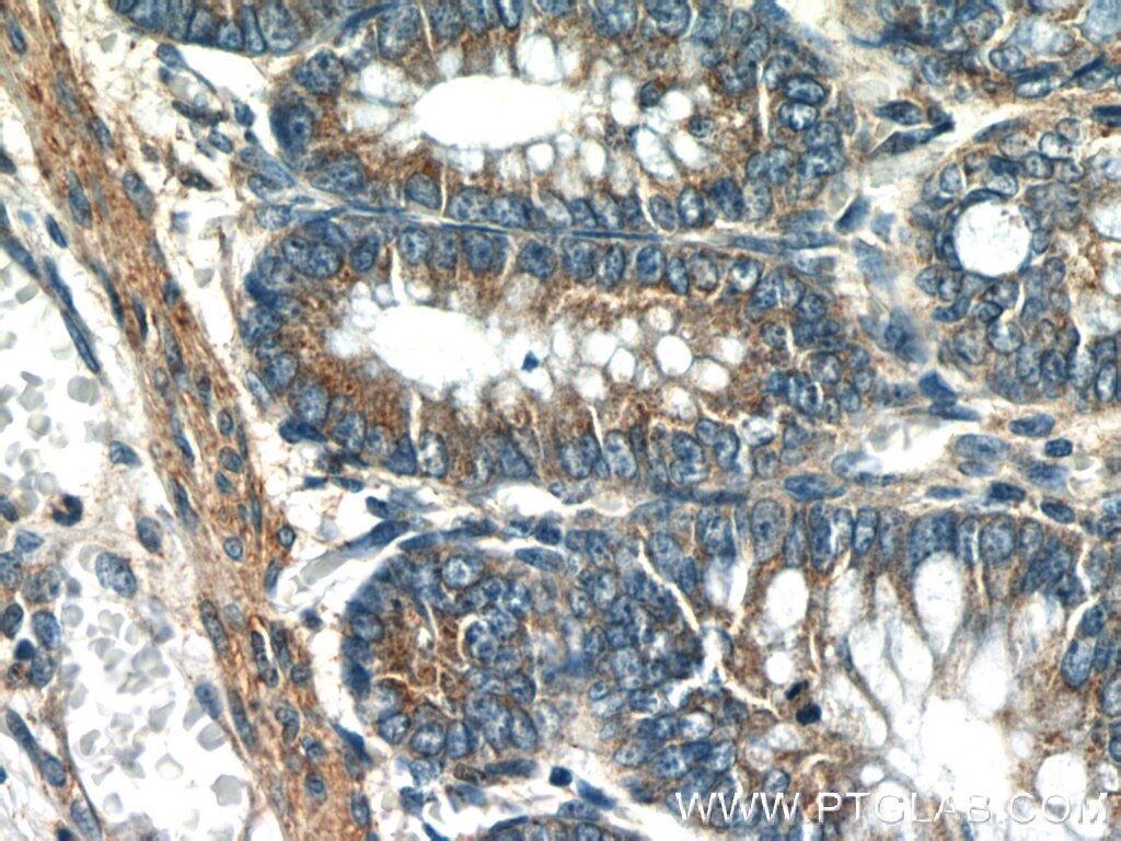 Immunohistochemistry (IHC) staining of human colon tissue using UBE2H Polyclonal antibody (15685-1-AP)