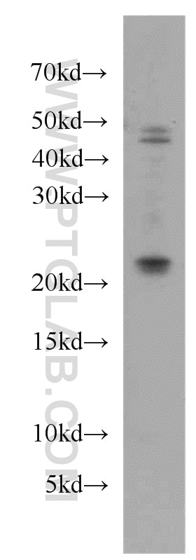 Western Blot (WB) analysis of mouse kidney tissue using UBE2H Polyclonal antibody (15685-1-AP)