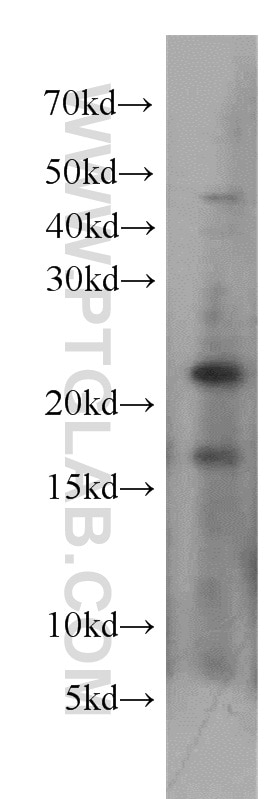 Western Blot (WB) analysis of HeLa cells using UBE2H Polyclonal antibody (15685-1-AP)