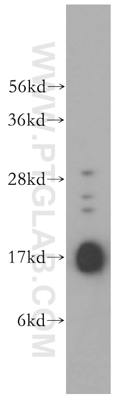 Western Blot (WB) analysis of human testis tissue using UBC9-Specific Polyclonal antibody (14837-1-AP)