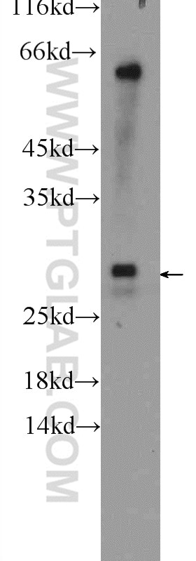 Western Blot (WB) analysis of mouse liver tissue using UBE2J2 Polyclonal antibody (17713-1-AP)