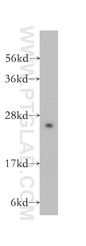 WB analysis of mouse testis using 11834-3-AP