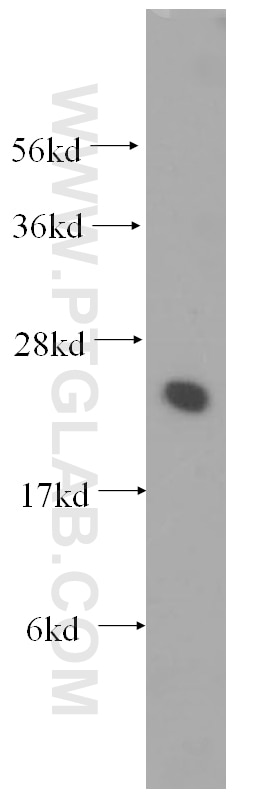 Western Blot (WB) analysis of human brain tissue using UBE2K Polyclonal antibody (11834-3-AP)