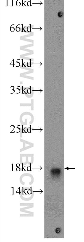 Western Blot (WB) analysis of rat kidney tissue using UBE2L3 Polyclonal antibody (14415-1-AP)