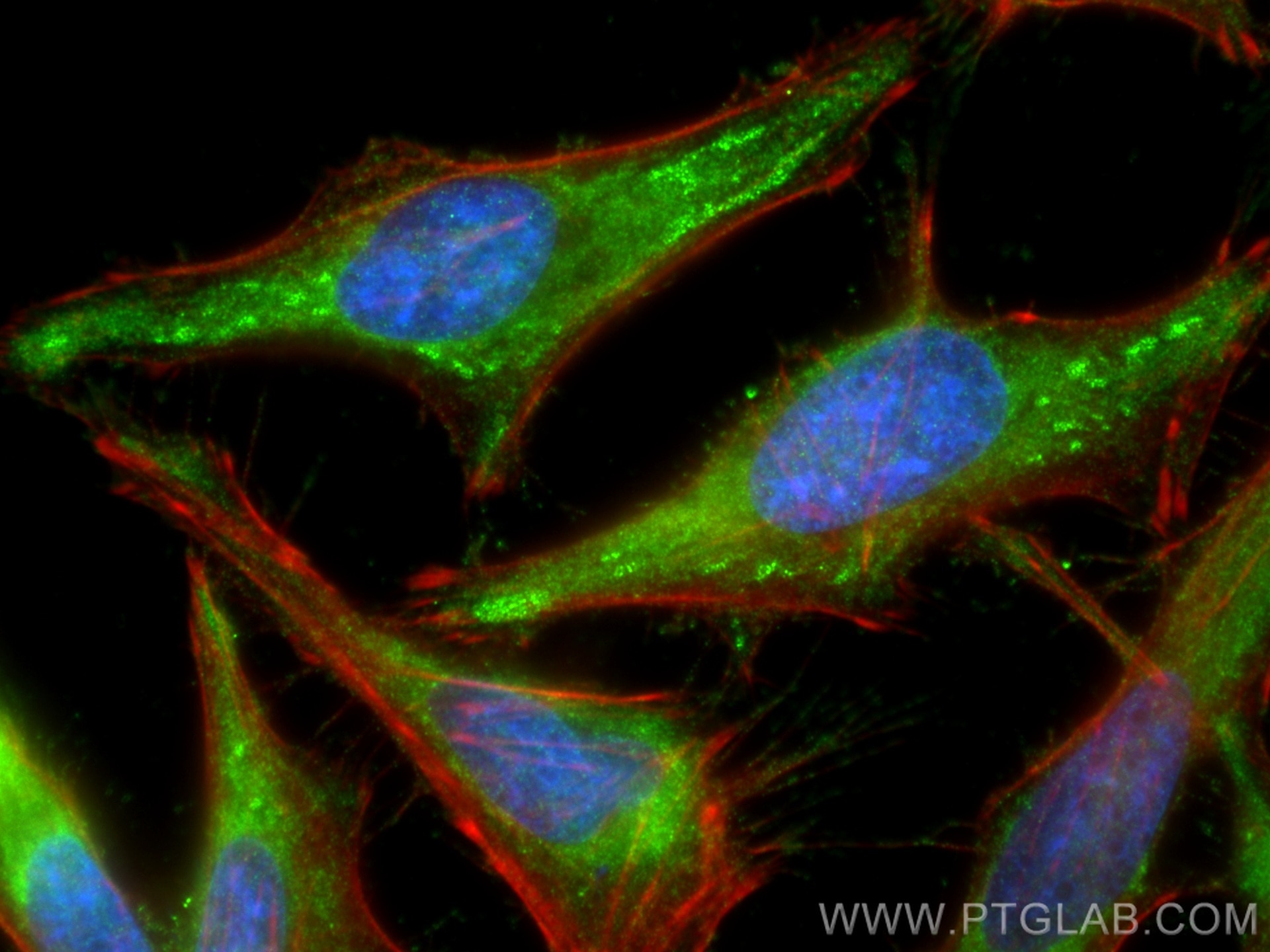 Immunofluorescence (IF) / fluorescent staining of HeLa cells using UBE2L6 Polyclonal antibody (17278-1-AP)