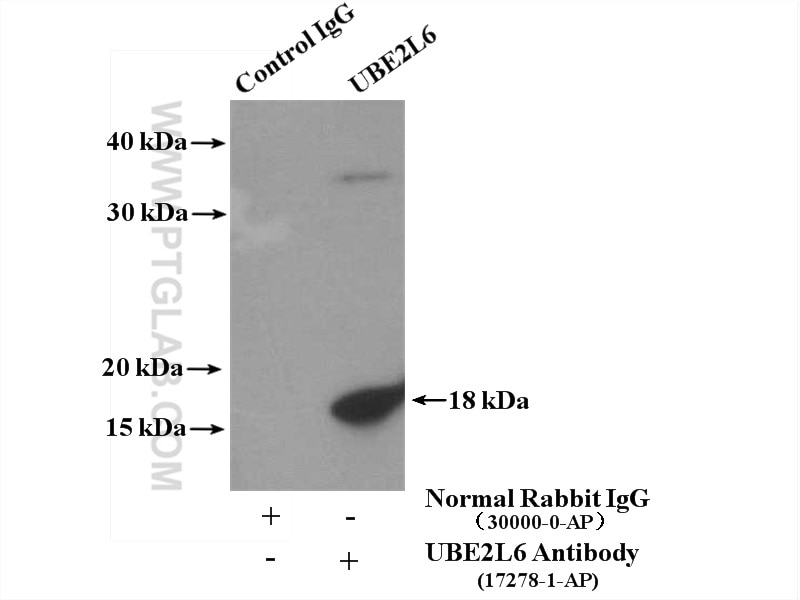 Immunoprecipitation (IP) experiment of Jurkat cells using UBE2L6 Polyclonal antibody (17278-1-AP)