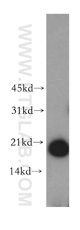 Western Blot (WB) analysis of Jurkat cells using UBE2L6 Polyclonal antibody (17278-1-AP)