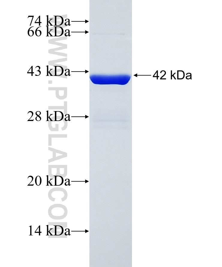 UBE2L6 fusion protein Ag11045 SDS-PAGE