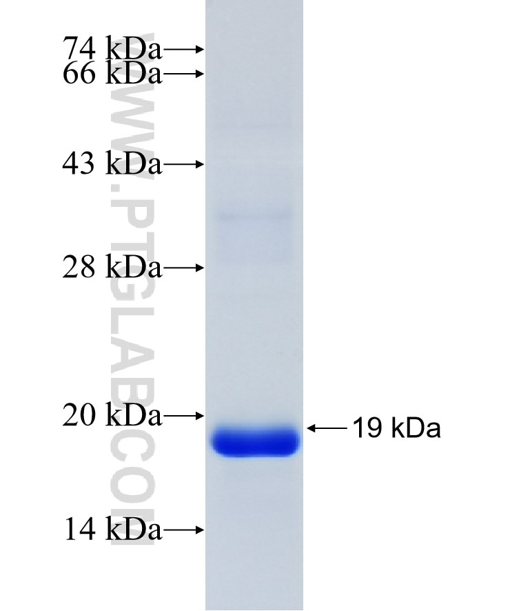 UBE2L6 fusion protein Ag11222 SDS-PAGE