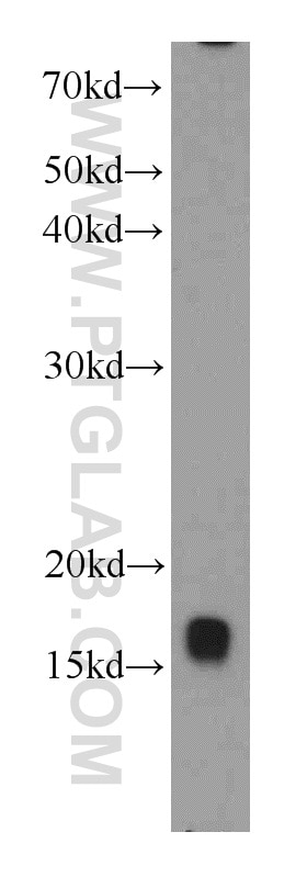 WB analysis of mouse thymus using 10243-1-AP